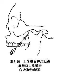 人口腔上牙重要还是下牙重要_重要通知图片(3)