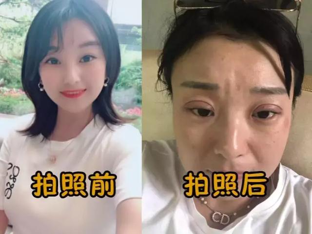 太原女子到沐浦影像拍婚纱照隔天肿成青蛙眼店家却拒绝负责