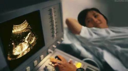 几个月做四维彩超图片 b44c7b7083544cc984cb95acbaf68ab7.jpeg