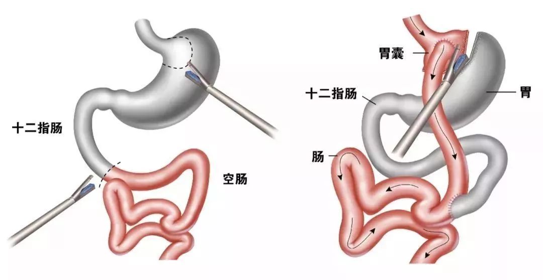 胃的原理是什么_胃左边是什么器官(2)