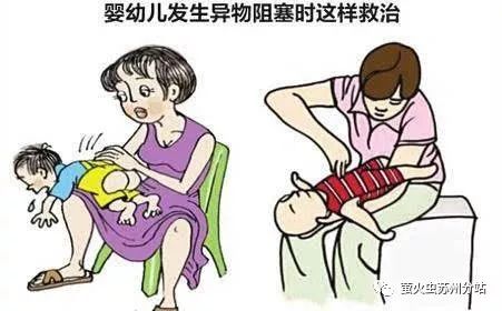 什么原因导致心脏停搏 d4a14214b9c141de9b52081a6ffcfabb.jpeg