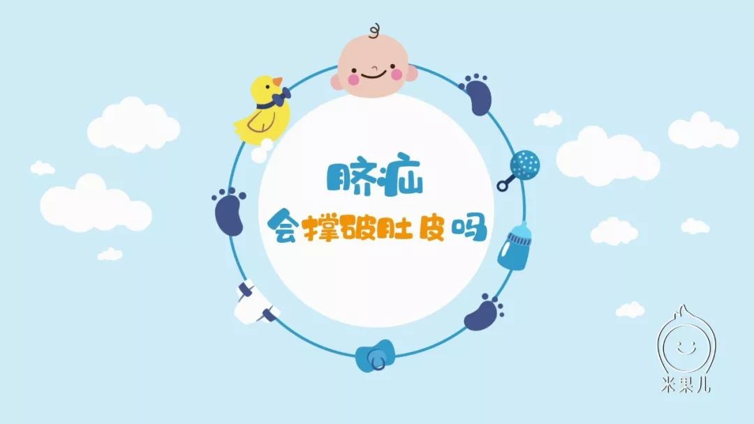                     原创            新生儿脐部鼓成球，脐疝会撑破宝宝的肚皮吗？