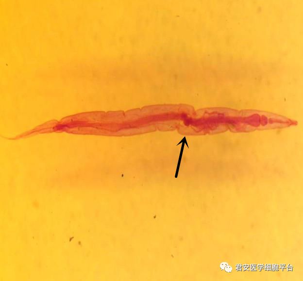 国家卫生健康委临床检验中心2019年第1次寄生虫形态学检查室间质量