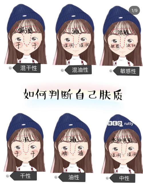 混合性皮肤:只有t型区容易出油,其他部位则呈现出中性或者干性皮肤的