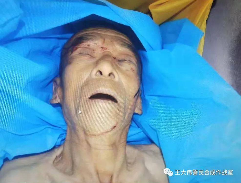 辨认老人尸体 | 丹东东港周边谁家老人失踪了?照片恐怖,未成年勿看!