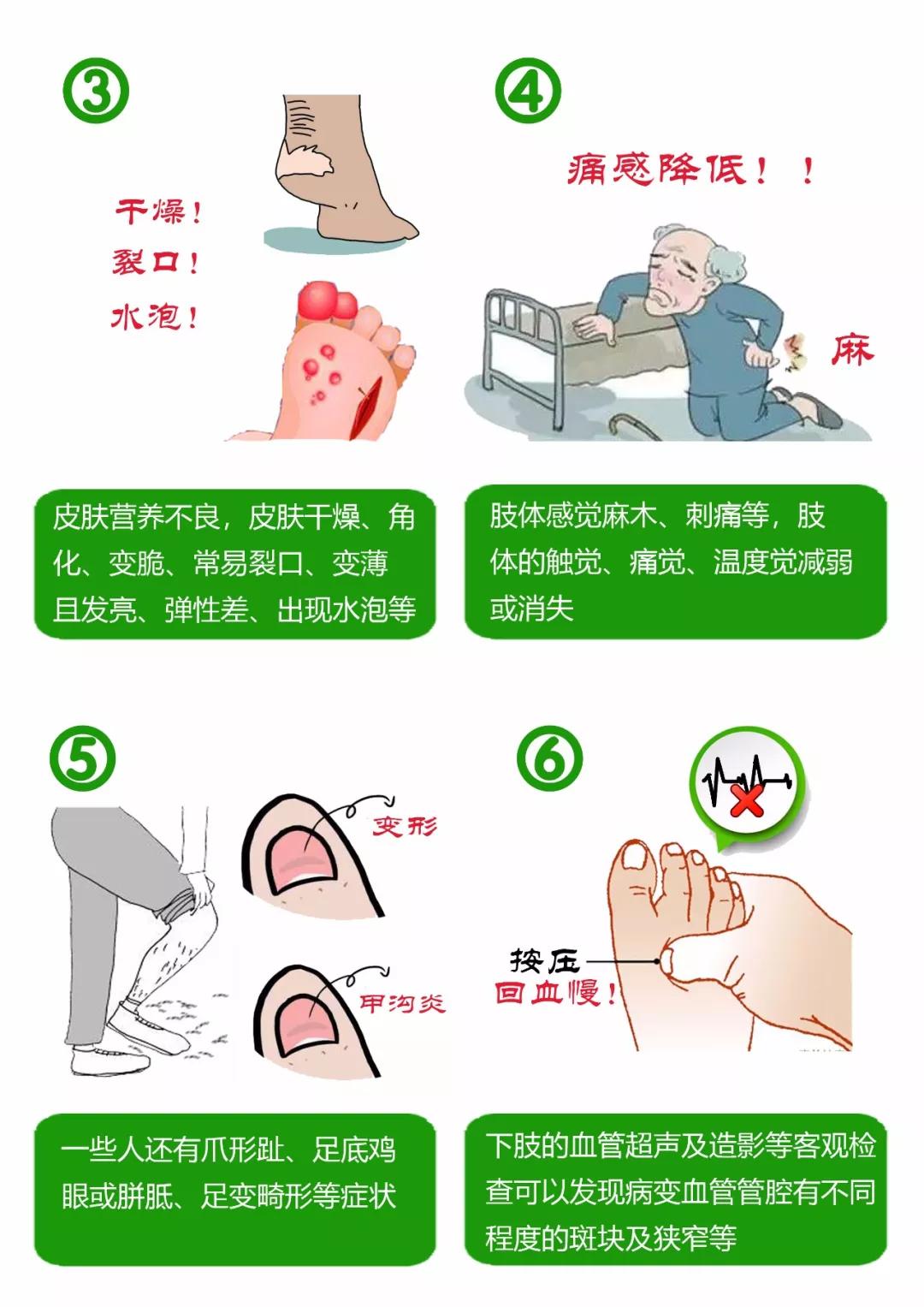 糖尿病脚开裂什么原理_糖尿病脚有什么症状