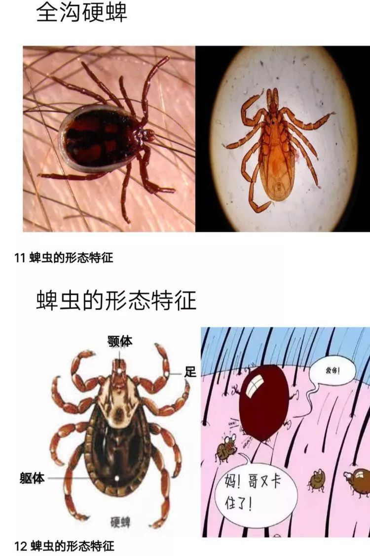 【地医-护理】小蜱虫大危害,急诊科护理查房——生活在我们身边的"