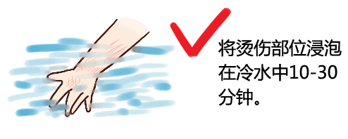                     一次小烫伤，4岁娃竟进ICU？爸爸后悔莫及...