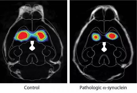 神经科学 · 对照组和实验组小鼠大脑黑质致密部产生多巴胺的神经