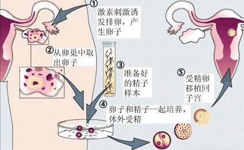 10年医导揭露泰国试管婴儿行业内幕:生呀生呀生儿子 娱乐九州2官方网址