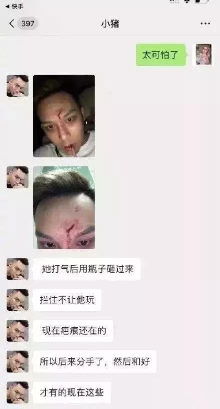 20岁就经历33次整容,多次流产,网红的世界真让人看不懂!_韩安冉