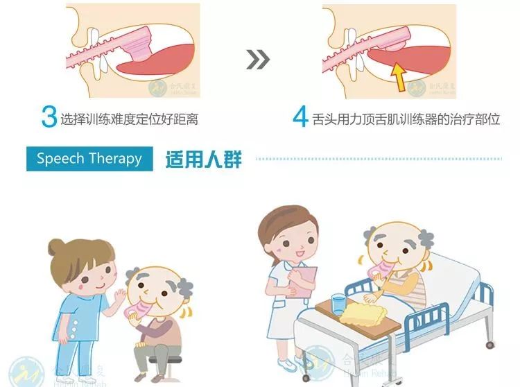 吞咽障碍的评估和治疗