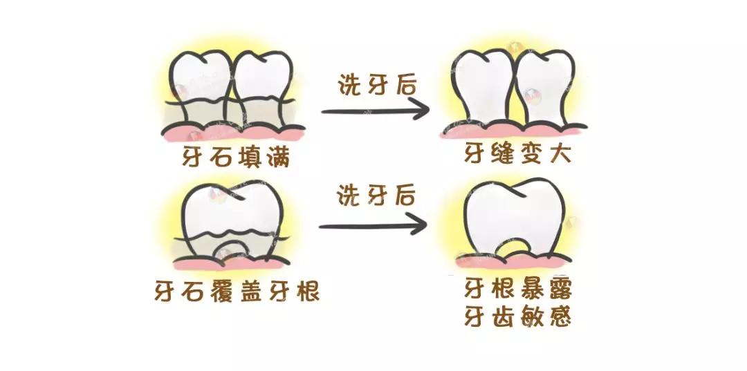 小德口腔漫画课堂喷砂洁牙你真的了解吗