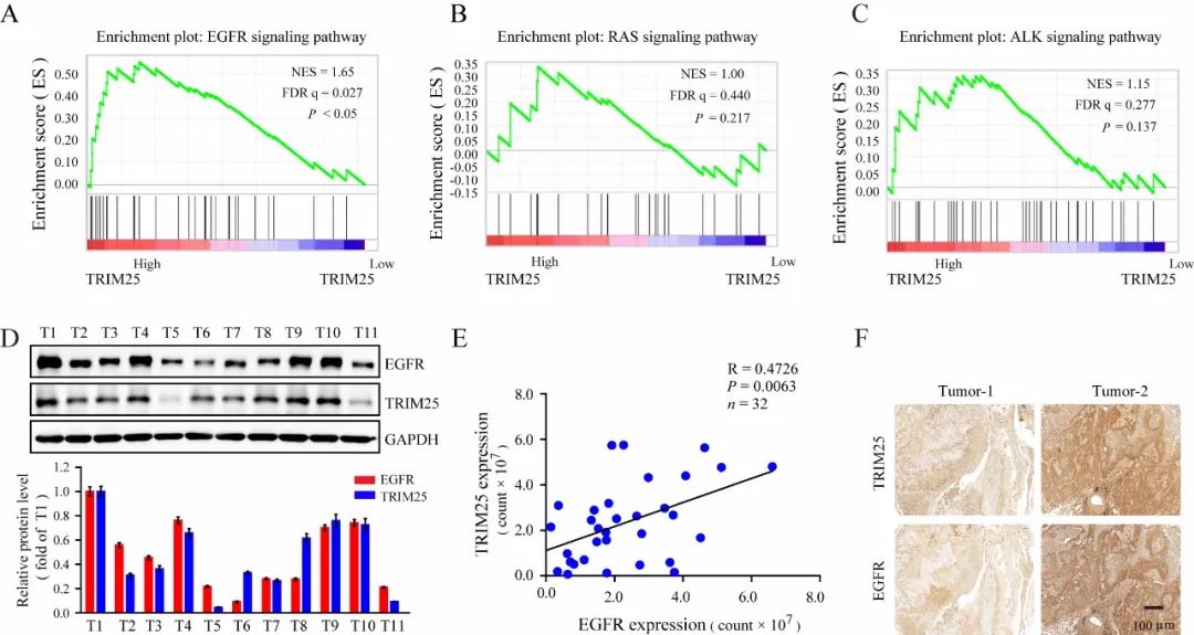 【封面推荐】trim25 增强egfr稳定性及信号促进肺癌发展侵袭 5009