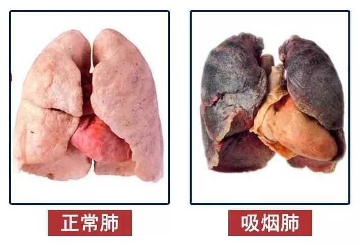 道生优选|水里加点它,清10年"肺毒",每天一杯,连多年的咽炎干咳都好了