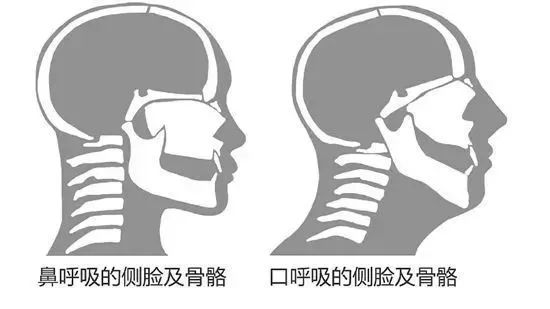                     宝宝鼻塞流鼻涕就打针吃药往医院跑？你那是在害孩子