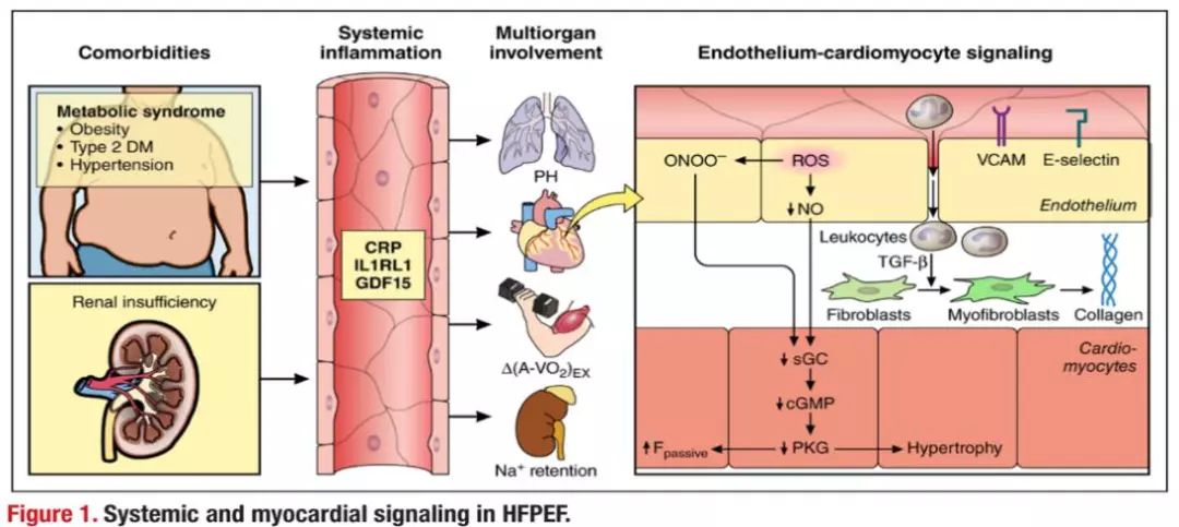 认识的重大转变:从"心脏"到"全身内皮细胞的炎症反应 hfpef:冠状