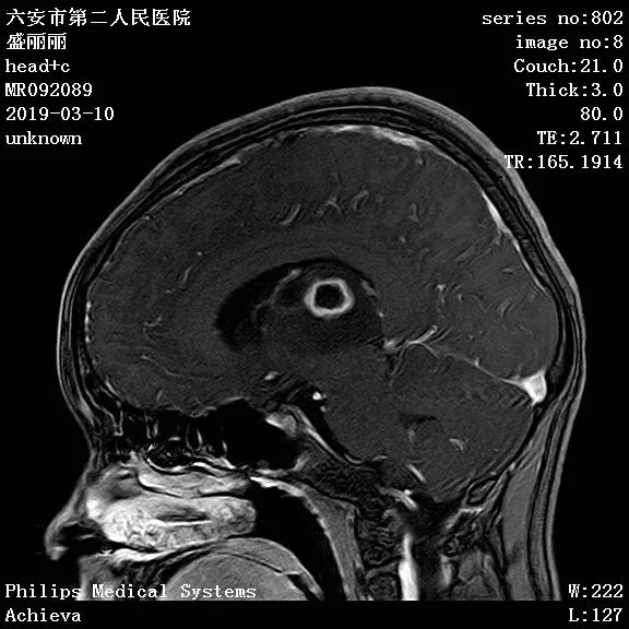 脑部病变等你分析读片专栏1119期