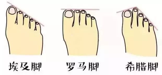 从脚趾去分类的话,我们亚洲人主要有这么三种脚型 罗马脚 埃及脚