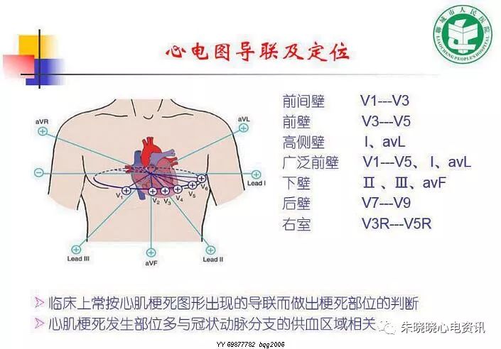 【yy语音】孔敬博老师:急性心肌梗死的心电图定位及临床意义2019-6-19