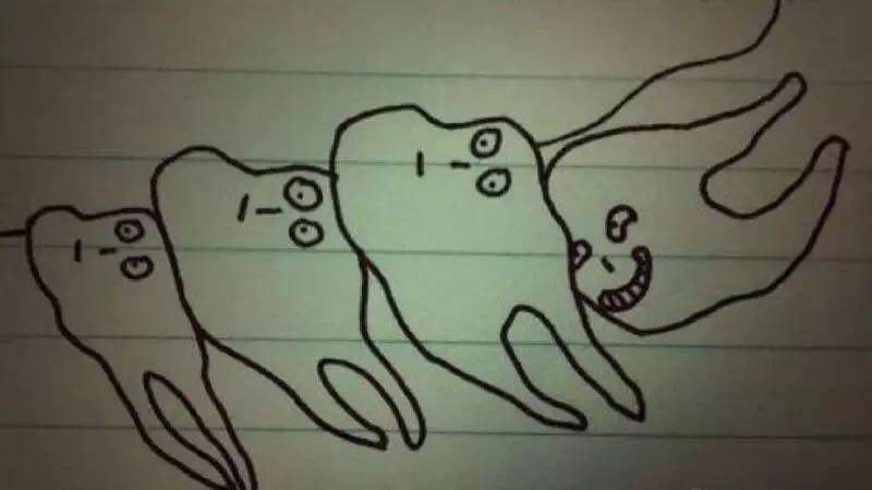 拔智齿费用为什么那么贵?