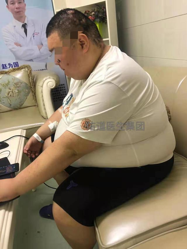 尺子不够量腰围,吃一顿饭胖12斤,380斤男孩如何减肥?