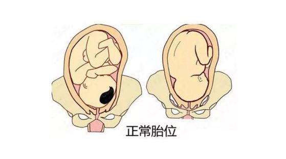 妊娠30周后经产前检查,发现臀位,横位,枕后位,颜面位等谓之胎位不正