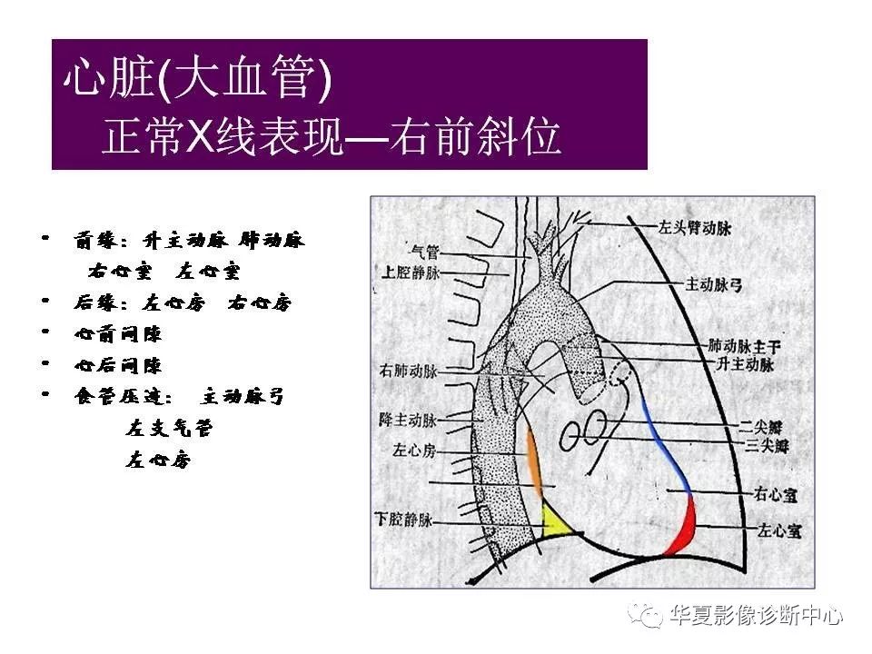 心脏大血管的影像学解剖