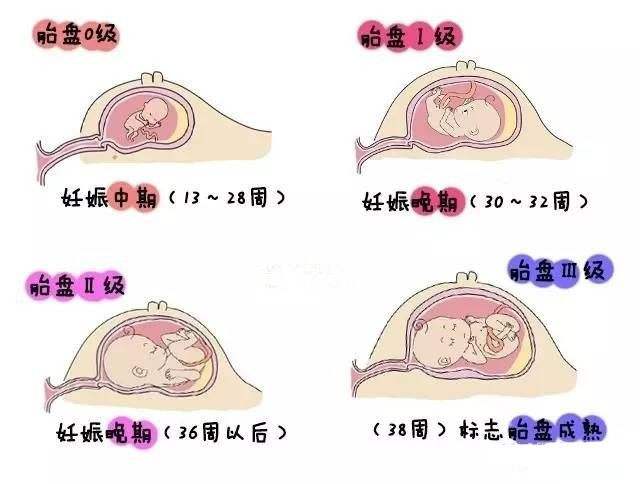 胎儿发育迟缓是怎么回事?孕妈要如何避免,请做好这几点