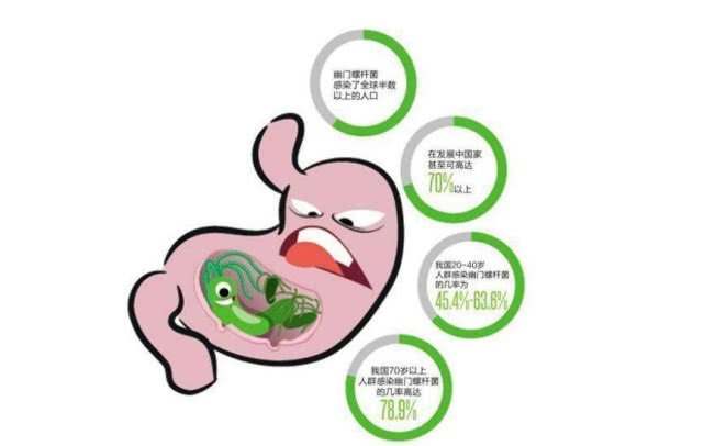 感染幽门螺杆菌阳性是导致胃病常见的主要原因,感染幽门螺旋杆菌之后