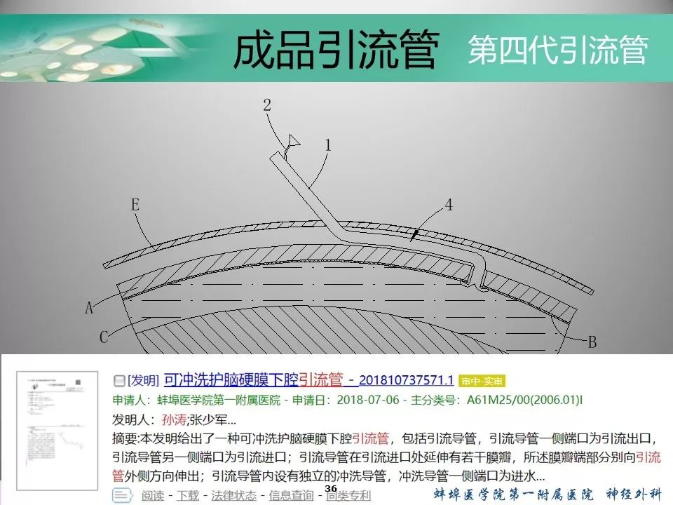 自制单管双腔引流管治疗慢性硬膜下血肿颅脑创伤神经重症病例周刊124