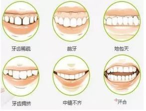 后牙反颌,锁颌,影响牙齿咬合功能,长期可能导致上下颌骨偏歪畸形.