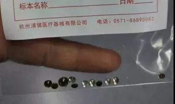                     瞠目结舌！浙江3岁小女孩把两只耳朵当口袋，在里面藏了十多颗“钻石”！
