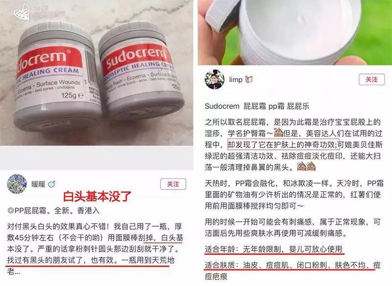 粉刺露的功效与作用 65265c62099740b2a639b1c5923a6a8d.jpeg