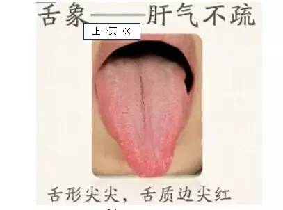 怎么看舌苔