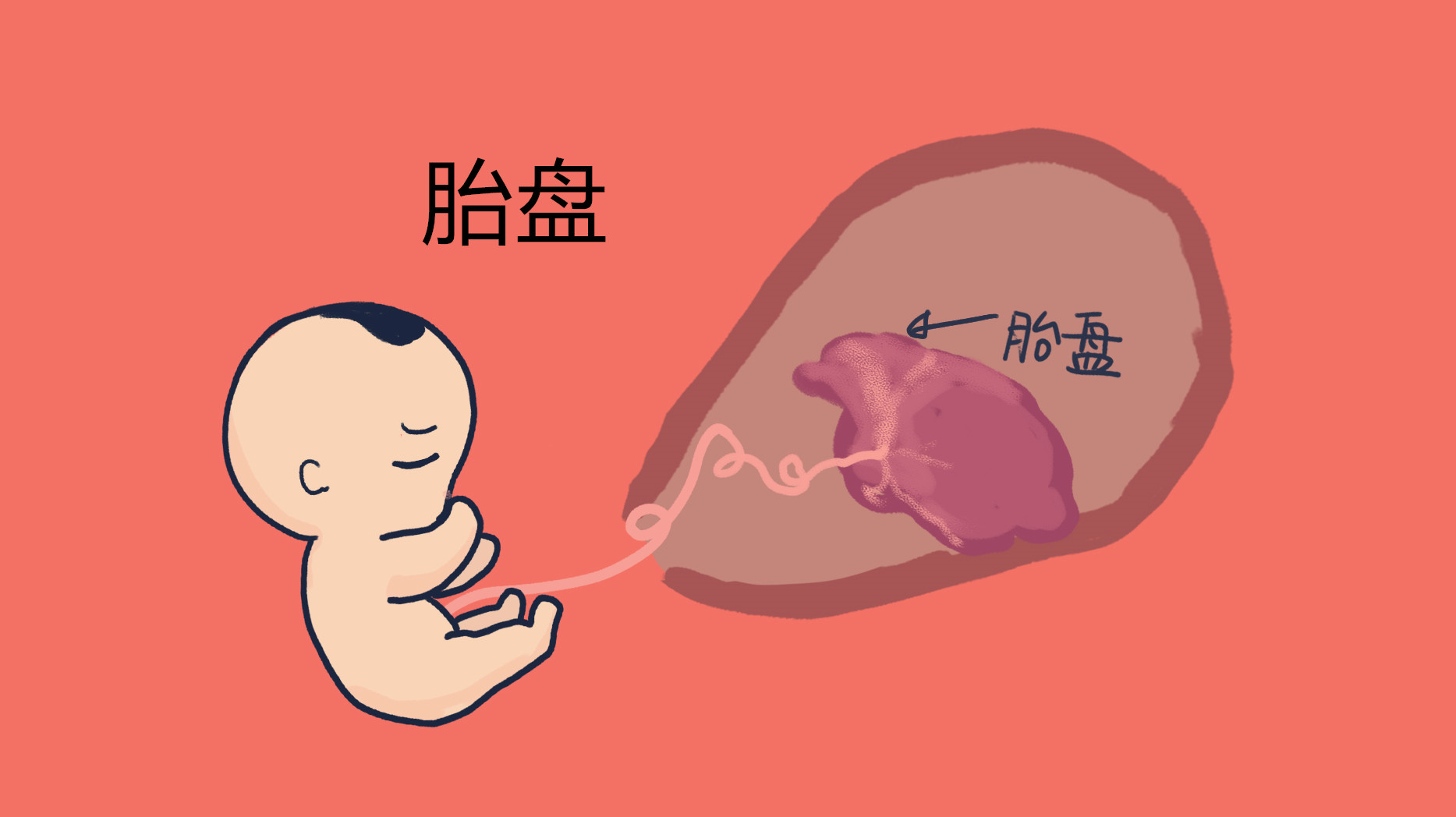 我的胎盘哪去了”,产科医生给出的建议,家属严格遵守了吗 Sunbet娱乐官网