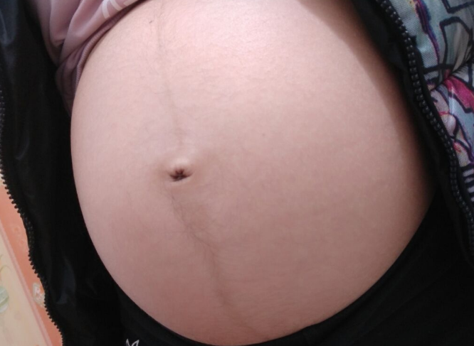                     有些孕妈的“肚脐”为何是凸出来的？这3个原因很重要，别大意