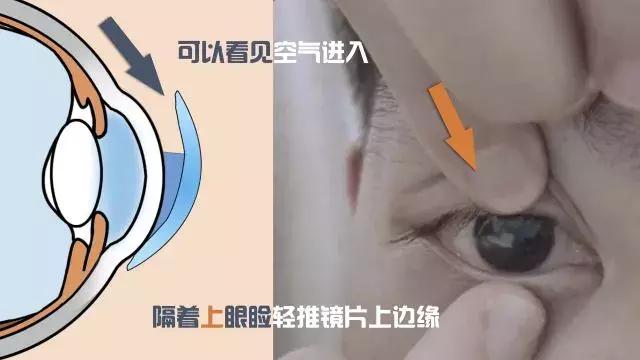 爱眼小贴士丨吸棒丢了,三步学会手摘OK镜