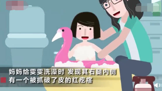                     原创            4岁女童被蚊虫叮咬，破皮部位脂肪和筋膜已经全部坏死