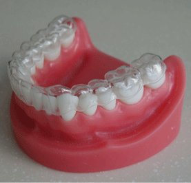 深圳牙齿矫正保持器科普