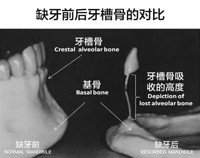 中国人口有多少人缺牙_中国有多少人口(2)