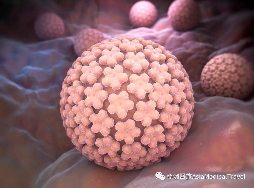 hpv病毒能彻底清除 993c6d28000248cbbb90c0a2f2b9df6f.jpeg