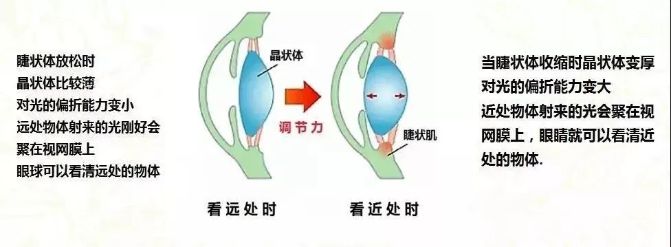 "睫状肌调节"已经被越来越多的人认知,"眼界"就是通过中医药疗法, 对