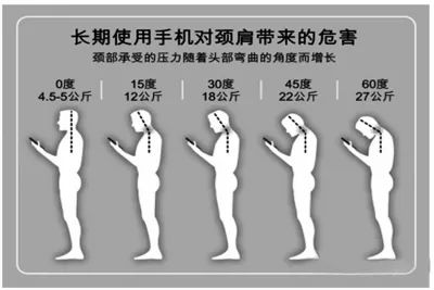 低头族颈椎承受可怕压力为了撑住我们的脑袋它们也是拼了