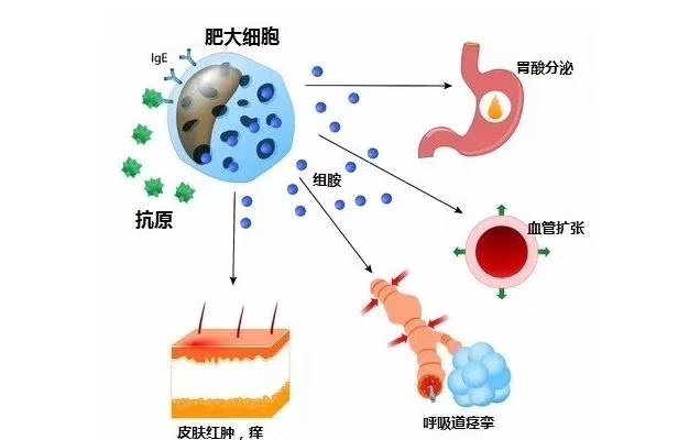 食物过敏的症状可能立即出现,也可能在吃完食物后两小时才出现.