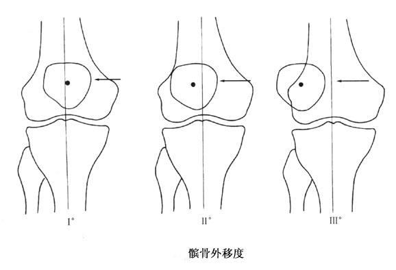 曲膝什么成语_成语故事简笔画(2)