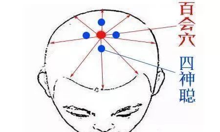 四神聪 位于百会穴(头顶部, 两耳尖连线的中点)前,后,左,右 各1寸处