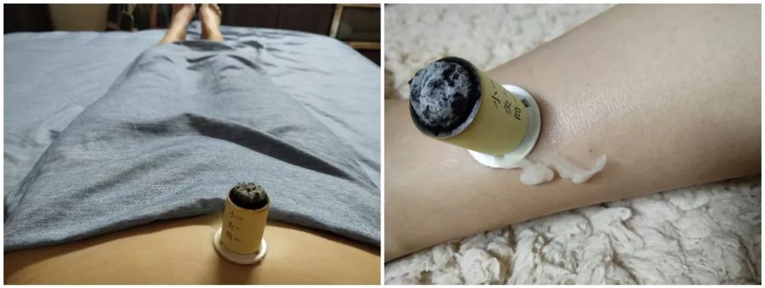 灸关元,三阴交,对宫寒有效 不仅气色变好了,还不知不觉瘦了6斤,简直是