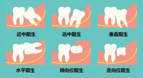 智齿是拔是留