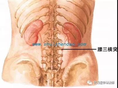 针刀治疗腰臀部疼痛